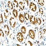 MUC1 Antibody in Immunohistochemistry (Paraffin) (IHC (P))