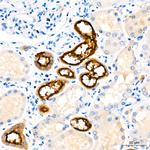 MUC1 Antibody in Immunohistochemistry (Paraffin) (IHC (P))