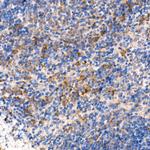 MyD88 Antibody in Immunohistochemistry (Paraffin) (IHC (P))