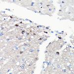 NMDAR2A Antibody in Immunohistochemistry (Paraffin) (IHC (P))