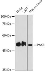 PAX6 Antibody in Western Blot (WB)