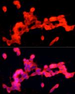 PGP9.5 Antibody in Immunocytochemistry (ICC/IF)