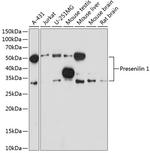 Presenilin 1 Antibody in Western Blot (WB)