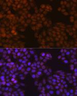 S100A4 Antibody in Immunocytochemistry (ICC/IF)