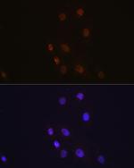 S100A4 Antibody in Immunocytochemistry (ICC/IF)