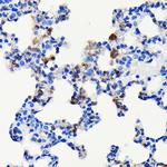 S100A4 Antibody in Immunohistochemistry (Paraffin) (IHC (P))