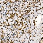 SMAD3 Antibody in Immunohistochemistry (Paraffin) (IHC (P))