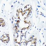 SUMO1 Antibody in Immunohistochemistry (Paraffin) (IHC (P))