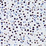 TDP-43 Antibody in Immunohistochemistry (Paraffin) (IHC (P))