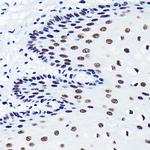 TDP-43 Antibody in Immunohistochemistry (Paraffin) (IHC (P))