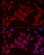 YAP1 Antibody in Immunocytochemistry (ICC/IF)