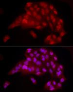 YAP1 Antibody in Immunocytochemistry (ICC/IF)