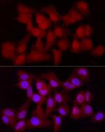 YAP1 Antibody in Immunocytochemistry (ICC/IF)