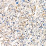 YAP1 Antibody in Immunohistochemistry (Paraffin) (IHC (P))