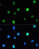 Lamin A/C Antibody in Immunocytochemistry (ICC/IF)