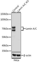 Lamin A/C Antibody