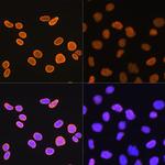 H4K5ac Antibody in Immunocytochemistry (ICC/IF)