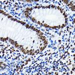 H4K5ac Antibody in Immunohistochemistry (Paraffin) (IHC (P))