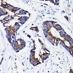 Prohibitin Antibody in Immunohistochemistry (Paraffin) (IHC (P))