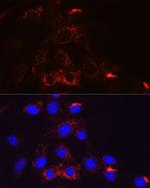 PDGFRB Antibody in Immunocytochemistry (ICC/IF)