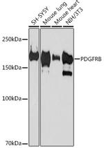 PDGFRB Antibody in Western Blot (WB)