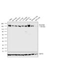 PDGFRB Antibody in Western Blot (WB)