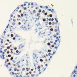 TCF7L2 Antibody in Immunohistochemistry (Paraffin) (IHC (P))