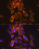 MEK1 Antibody in Immunocytochemistry (ICC/IF)