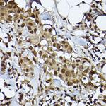 STAT3 Antibody in Immunohistochemistry (Paraffin) (IHC (P))