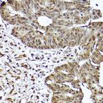 STAT3 Antibody in Immunohistochemistry (Paraffin) (IHC (P))