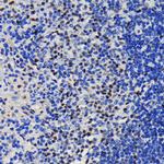 TRIM28 Antibody in Immunohistochemistry (Paraffin) (IHC (P))