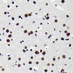 TRIM28 Antibody in Immunohistochemistry (Paraffin) (IHC (P))