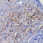 SOD2 Antibody in Immunohistochemistry (Paraffin) (IHC (P))