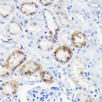 FAS Antibody in Immunohistochemistry (Paraffin) (IHC (P))