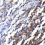 NFkB p52/p100 Antibody in Immunohistochemistry (Paraffin) (IHC (P))