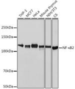 NFkB p52/p100 Antibody in Western Blot (WB)