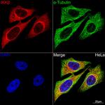 IKK beta Antibody in Immunocytochemistry (ICC/IF)