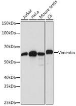 Vimentin Antibody in Western Blot (WB)