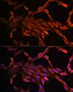 PAK1 Antibody in Immunocytochemistry (ICC/IF)