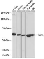 PAK1 Antibody in Western Blot (WB)