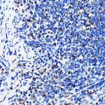 HuR Antibody in Immunohistochemistry (Paraffin) (IHC (P))