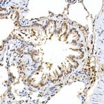 ERK2 Antibody in Immunohistochemistry (Paraffin) (IHC (P))