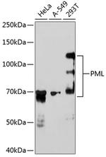 PML Antibody in Western Blot (WB)