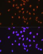 SP1 Antibody in Immunocytochemistry (ICC/IF)