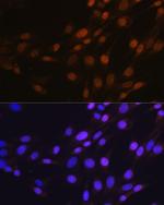 SP1 Antibody in Immunocytochemistry (ICC/IF)