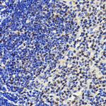 SP1 Antibody in Immunohistochemistry (Paraffin) (IHC (P))