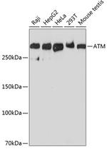 ATM Antibody in Western Blot (WB)