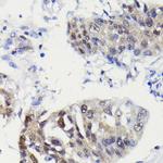 Caspase 3 p12 Antibody in Immunohistochemistry (Paraffin) (IHC (P))