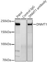 DNMT1 Antibody in Immunoprecipitation (IP)