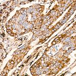 Cathepsin D Antibody in Immunohistochemistry (Paraffin) (IHC (P))